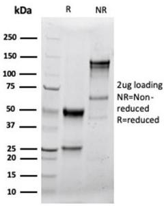 SDS-PAGE analysis of Anti-Granzyme B Antibody [GZMB/4539R] under non-reduced and reduced conditions; showing intact IgG and intact heavy and light chains, respectively. SDS-PAGE analysis confirms the integrity and purity of the antibody