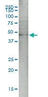 Anti-MAP2K5 Mouse Monoclonal Antibody [clone: M1-E6]