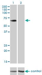 Anti-PLXDC1 Mouse Monoclonal Antibody [clone: 4B10]