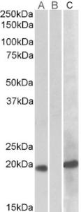 HEK293 lysate (10ug protein in RIPA buffer) overexpressing Human HOXA1 (RC222721) with C-terminal MYC tag probed with EB09847 (1 µg/ml) in Lane A and probed with anti-MYC Tag (1/1000) in lane C. Mock-transfected HEK293 probed with EB09847 (1mg/ml) in Lane