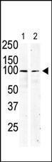 Anti-SCFR Rabbit Polyclonal Antibody (HRP (Horseradish Peroxidase))