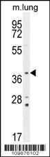 Anti-TWF2 Rabbit Polyclonal Antibody (PE (Phycoerythrin))