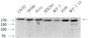 Western blot analysis of various cells using Anti-BRCA1 Antibody at 1:1,000 (4°C overnight). Goat Anti-Rabbit IgG (IRDye 800) was used as a secondary at 1:5,000 (25°C, 1 hour).