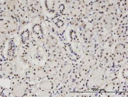 Anti-CBFA2T2 Mouse Monoclonal Antibody [clone: 2C10]