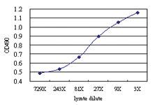 Anti-USP33 Antibody Pair