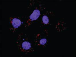 Anti-STAT1 + PIAS1 Antibody Pair