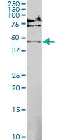 Anti-MAP2K5 Mouse Monoclonal Antibody [clone: M1-E6]