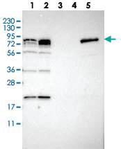 Anti-PNPLA8 Rabbit Polyclonal Antibody