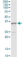 Anti-SGCG Antibody Pair