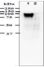 Anti-Varicella Zoster Virus gE Antibody