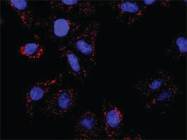 Anti-STAT1 + PIAS1 Antibody Pair