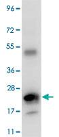 Anti-IL6 Rabbit Polyclonal Antibody