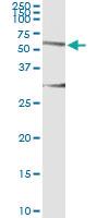 Anti-HERPUD1 Antibody Pair