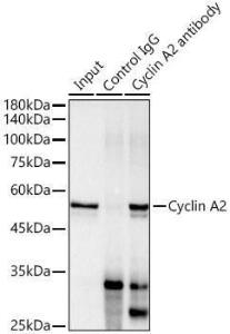 Immunoprecipitation analysis of 300 µg extracts of HeLa cells using 3 µg of Anti-Cyclin A2 Antibody [ARC0359] (A308964). This Western blot was performed on the immunoprecipitate using Anti-Cyclin A2 Antibody [ARC0359] (A308964) at a dilution of 1:1000