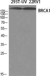 Immunohistochemical analysis of paraffin-embedded human uterus tissue using Anti-BRCA1 Antibody at 1:200 (4°C overnight). Negative control was secondary antibody only.