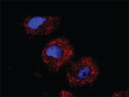 Anti-TGFB1 + DAXX Antibody Pair