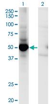 Anti-MAP2K5 Mouse Monoclonal Antibody [clone: M1-E6]