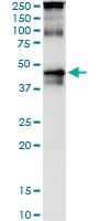 Anti-TARBP2 Antibody Pair