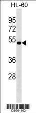 Anti-NAAA Rabbit Polyclonal Antibody (HRP (Horseradish Peroxidase))