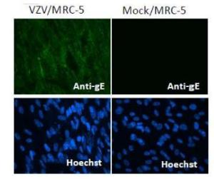 Anti-Varicella Zoster Virus gE Antibody