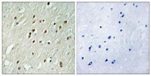 Immunohistochemical analysis of paraffin-embedded human brain using Anti-CNTROB Antibody. The right hand panel represents a negative control, where the antibody was pre-incubated with the immunising peptide