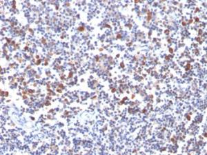 Immunohistochemical analysis of formalin-fixed, paraffin-embedded human tonsil using Anti-CD134 Antibody [OX40/3427]