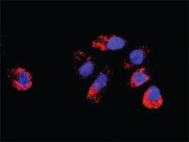 Anti-TGFB1 + DAXX Antibody Pair