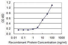 Anti-MBNL1 Mouse Monoclonal Antibody [clone: 1D11]