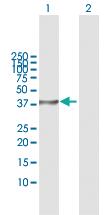 Anti-STK19 Rabbit Polyclonal Antibody