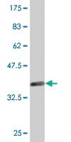 Anti-DFFA Mouse Monoclonal Antibody [clone: 3A11]