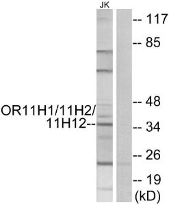 Western blot analysis of lysates from Jurkat cells using Anti-OR11 h1 + OR11 h2 + OR11 h12 Antibody. The right hand lane represents a negative control, where the Antibody is blocked by the immunising peptide