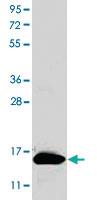 Anti-CSF2 Rabbit Polyclonal Antibody