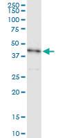 Anti-STK19 Rabbit Polyclonal Antibody