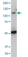 Anti-TLR7 Mouse Monoclonal Antibody [clone: 2C9]