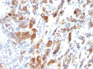 Anti-Mucin 5AC antibody