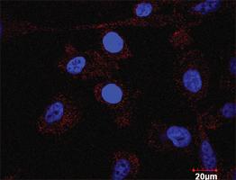 Anti-TGFB1 + DAXX Antibody Pair