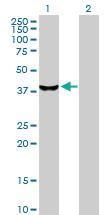 Anti-STK19 Rabbit Polyclonal Antibody