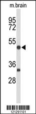 Anti-PKN3 Rabbit Polyclonal Antibody