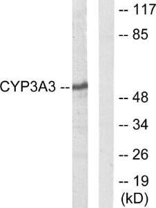 Western blot analysis of lysates from Jurkat cells using Anti-Cytochrome P450 3A4 + 3A5 Antibody. The right hand lane represents a negative control, where the antibody is blocked by the immunising peptide