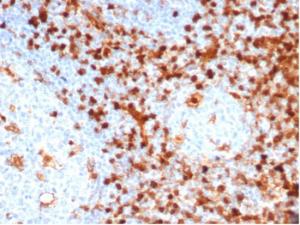 Immunohistochemical analysis of formalin-fixed, paraffin-embedded human tonsil tissue using Anti-Annexin A1 Antibody [ANXA1/6452R]