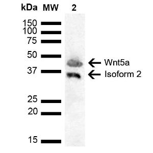 Western blot analysis of human Cervical cancer cell line (HeLa) lysate showing detection of ~42.3 kDa Wnt5a protein using Anti-Wnt5a Antibody (A304879) at 1:1000 for 2 hours at room temperature. Lane 1: Molecular Weight Ladder (MW)