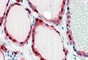 Anti-FZD2 Antibody (A84472) (2.5 µg/ml) staining of paraffin embedded Human Thyroid Gland. Steamed antigen retrieval with citrate buffer pH 6, AP-staining