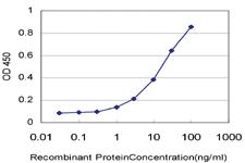 Anti-LDB1 Mouse Monoclonal Antibody [clone: 2G9]