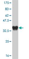 Anti-CXCR4 Mouse Monoclonal Antibody [clone: 2H5]