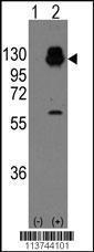 Anti-CDH13 Rabbit Polyclonal Antibody (AP (Alkaline Phosphatase))