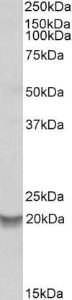 Anti-BCL2A1 Antibody (A82875) (0.2 µg/ml) staining of Human Bone Marrow lysate (35 µg protein in RIPA buffer). Primary incubation was 1 hour. Detected by chemilu minescence