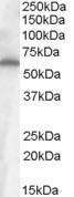 Anti-FZD4 Antibody (A84473) (1 µg/ml) staining of Small Intestine (Ileum) cell lysate (35 µg protein in RIPA buffer). Primary incubation was 1 hour. Detected by chemilu minescence