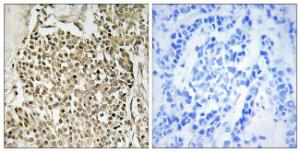 Anti-CEP350 Rabbit Polyclonal Antibody