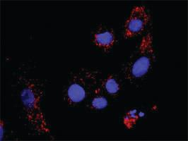 Anti-RUNX1T1 + HDAC1 Antibody Pair