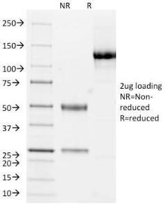 SDS-PAGE analysis of Anti-Cytokeratin 10 + 13 Antibody [DE-K13] under non-reduced and reduced conditions; showing intact IgG and intact heavy and light chains, respectively. SDS-PAGE analysis confirms the integrity and purity of the antibody